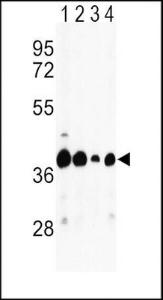 Anti-GOT2 Rabbit Polyclonal Antibody (PE (Phycoerythrin))