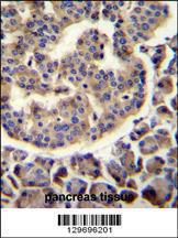 Anti-TRIM72 Rabbit Polyclonal Antibody