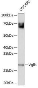 Western blot analysis of extracts of OVCAR3 cells, using Anti-Vgll4 Antibody (A307497) at 1:1,000 dilution