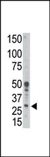 Anti-BCL2A1 Rabbit Polyclonal Antibody