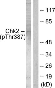 Western blot analysis of lysates from Jurkat cells using Anti-Chk2 (phospho Thr387) Antibody. The right hand lane represents a negative control, where the antibody is blocked by the immunising peptide.