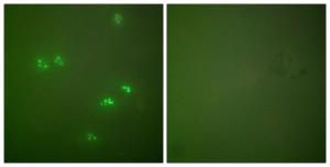 Anti-CDKN2A/p14ARF Rabbit Polyclonal Antibody