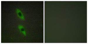 Immunofluorescence analysis of HUVEC cells using Anti-FADD Antibody. The right hand panel represents a negative control, where the antibody was pre-incubated with the immunising peptide