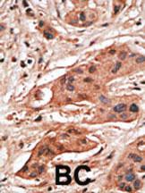 Anti-BCL2A1 Rabbit Polyclonal Antibody