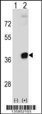 Anti-PRPS2 Rabbit Polyclonal Antibody (AP (Alkaline Phosphatase))