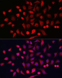 Anti-Cytokeratin 16/K16 antibody