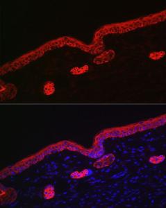 Anti-Cytokeratin 16/K16 antibody