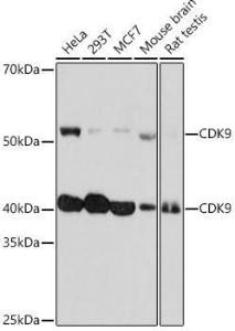 Anti-Cdk9 antibody