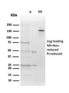 Anti-Estrogen Receptor beta 2 Mouse Monoclonal Antibody [clone: 57/3]