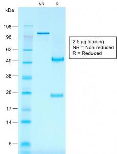 SDS-PAGE analysis of Anti-CD30 Antibody [rKi-1/779] under non-reduced and reduced conditions; showing intact IgG and intact heavy and light chains, respectively. SDS-PAGE analysis confirms the integrity and purity of the antibody