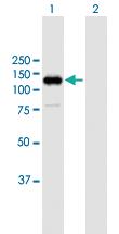 Anti-RB1 Mouse Polyclonal Antibody