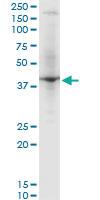 Anti-RNF2 Mouse Monoclonal Antibody [clone: 3G6]