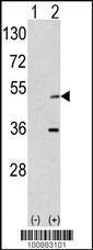 Anti-AURKA Rabbit Polyclonal Antibody (HRP (Horseradish Peroxidase))