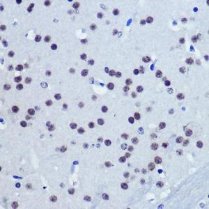 Immunohistochemistry analysis of paraffin-embedded mouse brain using Anti-Vgll4 Antibody (A307497) at a dilution of 1:100 (40X lens). Perform microwave antigen retrieval with 10 mM Tris/EDTA buffer pH 9.0 before commencing with IHC staining protocol