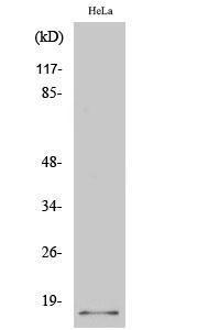 Anti-CDKN2A/p14ARF Rabbit Polyclonal Antibody