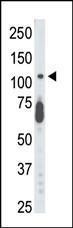 Anti-CDKL5 Rabbit Polyclonal Antibody (AP (Alkaline Phosphatase))