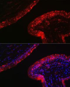 Anti-Cytokeratin 16/K16 antibody