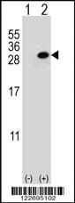 Anti-CLTA Rabbit Polyclonal Antibody