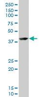 Anti-RNF2 Mouse Monoclonal Antibody [clone: 3G6]