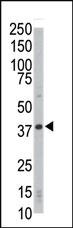 Anti-CDK4 Rabbit Polyclonal Antibody