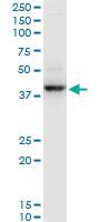 Anti-RNF2 Mouse Monoclonal Antibody [clone: 3G6]