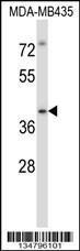 Anti-IRAK4 Rabbit Polyclonal Antibody