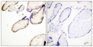 Immunohistochemical analysis of paraffin-embedded human placenta using Anti-CDC37 (phospho Ser13) Antibody. The right hand panel represents a negative control, where the antibody was pre-incubated with the immunising peptide