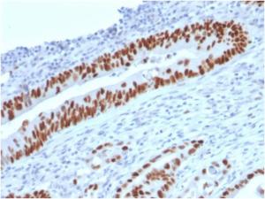 Anti-p53 Mouse Monoclonal Antibody [clone: TP53/2719]