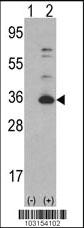 Anti-CDK4 Rabbit Polyclonal Antibody