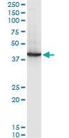 Anti-RNF2 Mouse Monoclonal Antibody [clone: 3G6]