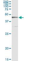 Anti-CRLF1 Antibody Pair