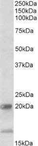 EB12088 (2 µg/ml) staining of Human Ileum lysate (35 µg protein in RIPA buffer). Primary incubation was 1 hour. Detected by chemiluminescence.