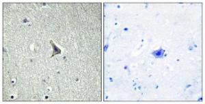 Immunohistochemical analysis of paraffin-embedded human brain tissue using Anti-GPR137C Antibody. The right hand panel represents a negative control, where the antibody was pre-incubated with the immunising peptide