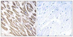 Immunohistochemical analysis of paraffin-embedded human heart tissue using Anti-F13B Antibody The right hand panel represents a negative control, where the antibody was pre-incubated with the immunising peptide