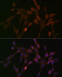 Immunofluorescence analysis of NIH-3T3 cells using Anti-MCJ Antibody [ARC0249] (A305809) at a dilution of 1:100 (40x lens). DAPI was used to stain the cell nuclei (blue).