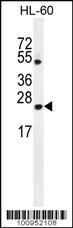 Anti-BAX Rabbit Polyclonal Antibody