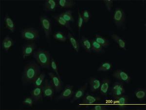 Anti-TAF11 Mouse Monoclonal Antibody [clone: 3D3]