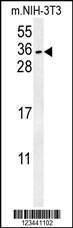 Anti-CITED2 Rabbit Polyclonal Antibody (PE (Phycoerythrin))