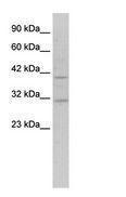 Anti-SIRT6 Rabbit Polyclonal Antibody