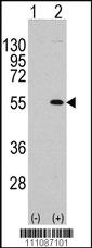 Anti-MEF2C Rabbit Polyclonal Antibody