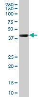 Anti-RNF2 Mouse Monoclonal Antibody [clone: 3G6]