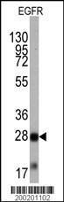 Anti-EGFR Mouse monoclonal antibody [clone: 10i41]