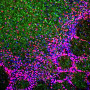 Immunofluorescent analysis of rat olfactory bulb section stained with Anti-MeCP2 Antibody (1:2000 / red) and co-stained with Anti-alpha Synuclein Antibody (1:1000 / green)