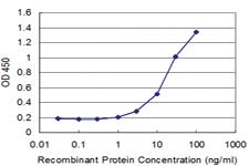 Anti-RNF2 Mouse Monoclonal Antibody [clone: 3G6]