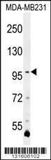 Anti-PCDHA3 Rabbit Polyclonal Antibody (AP (Alkaline Phosphatase))