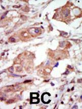 Anti-MAP3K10 Rabbit Polyclonal Antibody (APC (Allophycocyanin))