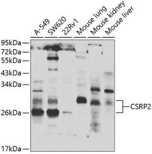 Western blot analysis of extracts of various cell lines, using Anti-CSRP2/Dlp1 Antibody (A10161) at 1:1,000 dilution The secondary antibody was Goat Anti-Rabbit IgG H&L Antibody (HRP) at 1:10,000 dilution Lysates/proteins were present at 25 µg per lane