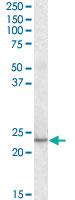 Anti-KLF16 Goat Polyclonal Antibody