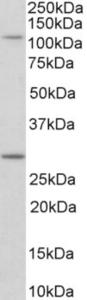 EB12108 (0.1 µg/ml) staining of NIH3T3 lysate (35 µg protein in RIPA buffer). Primary incubation was 1 hour. Detected by chemiluminescence.