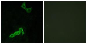 Immunofluorescence analysis of MCF7 cells using Anti-GPR137C Antibody. The right hand panel represents a negative control, where the antibody was pre-incubated with the immunising peptide